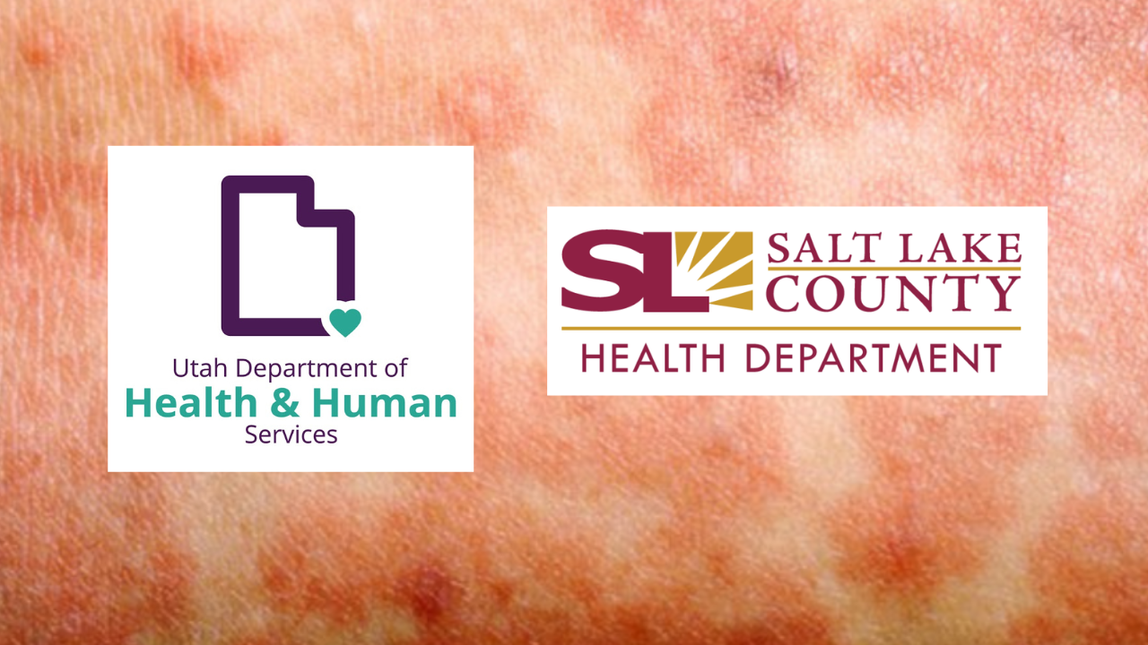 Measles Utah.png