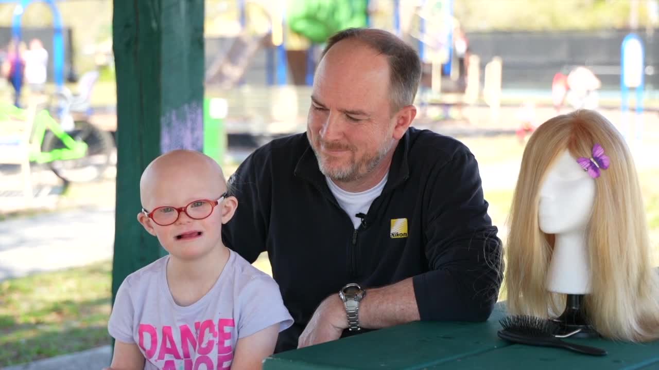 Emily and Jeremy's story dealing with alopecia and hair loss