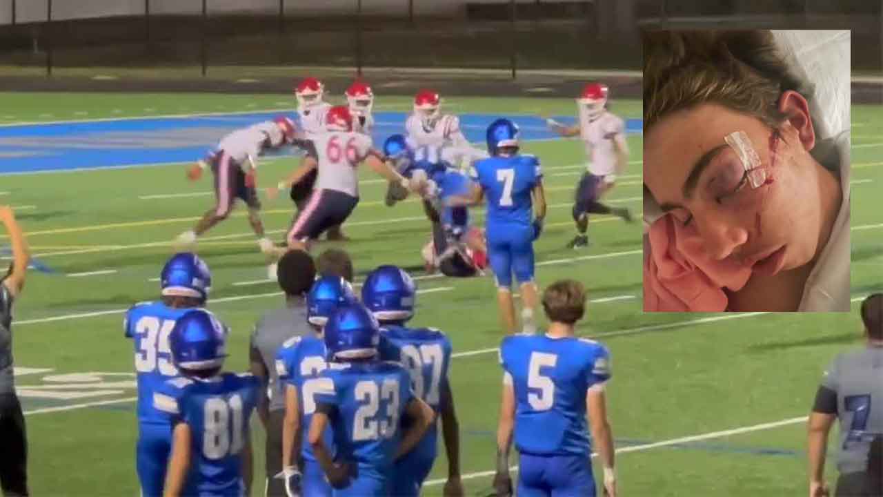 Wellington Flag Football Injury