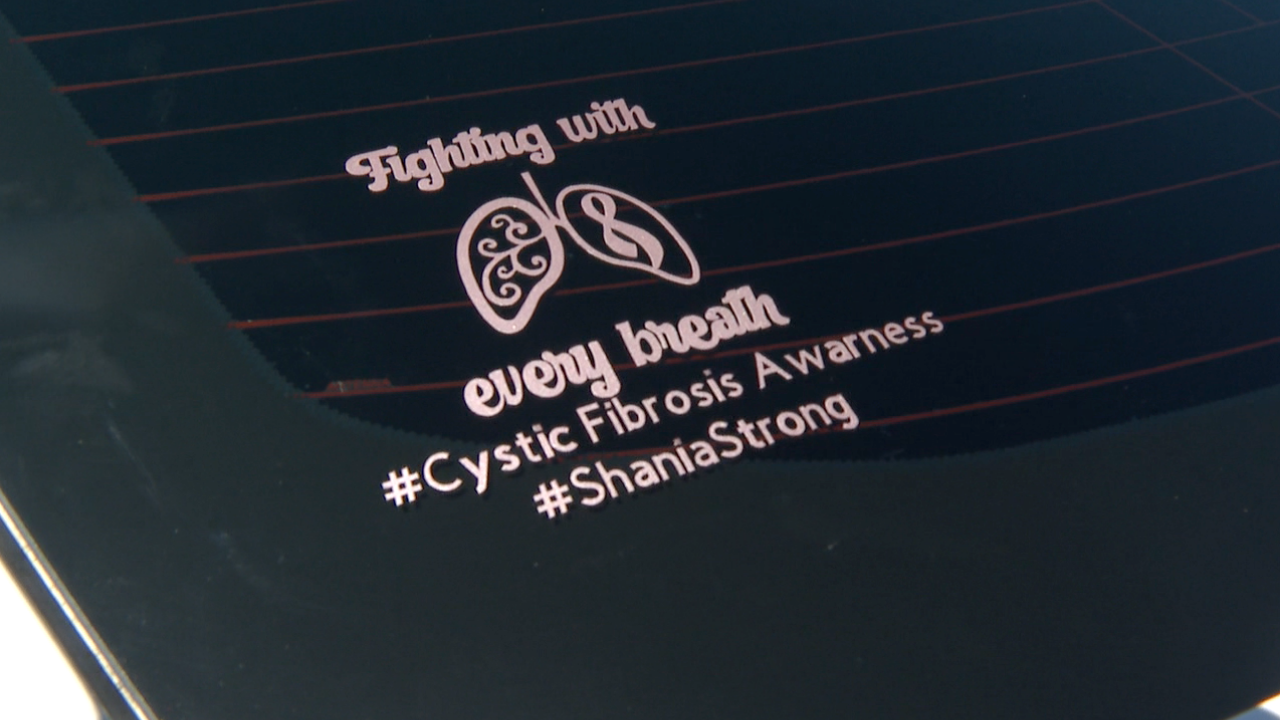 Polk County community helping young woman raise money for lung transplant 