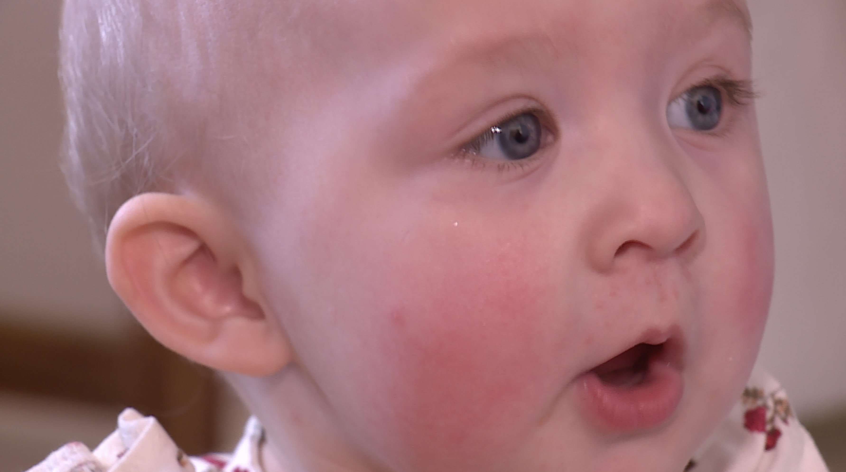 Baby Olivia liver transplant