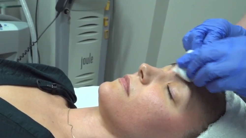 blood facial vampire