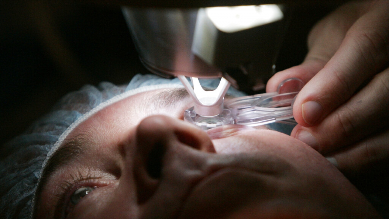 Dr. Colman Kraff docks the femtosecond laser, flattening the cornea, of patient Steve Parker .