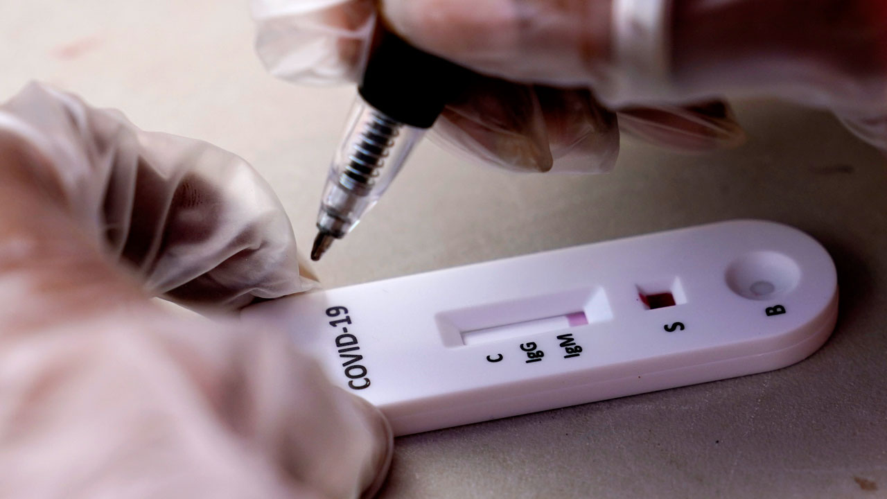 COVID-19 antibody test