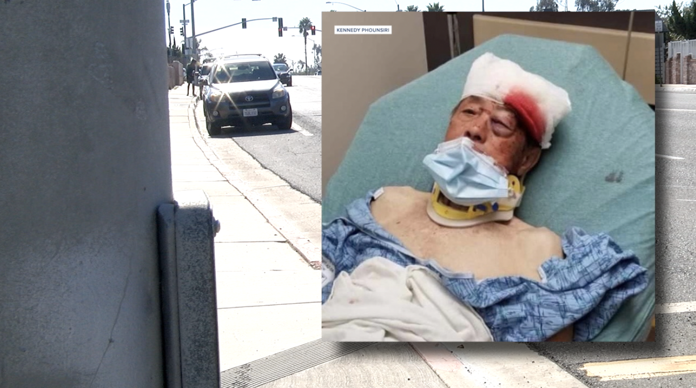SDPD INVESTIGATING ASIAN HATE CRIME - VICTIM MARK SANOUVONG.png