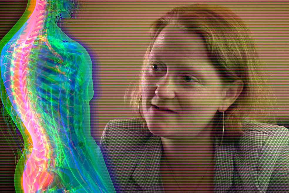 'It's not something that you see:' Multiple Sclerosis is a disease hiding in plain sight, here's what to look out for