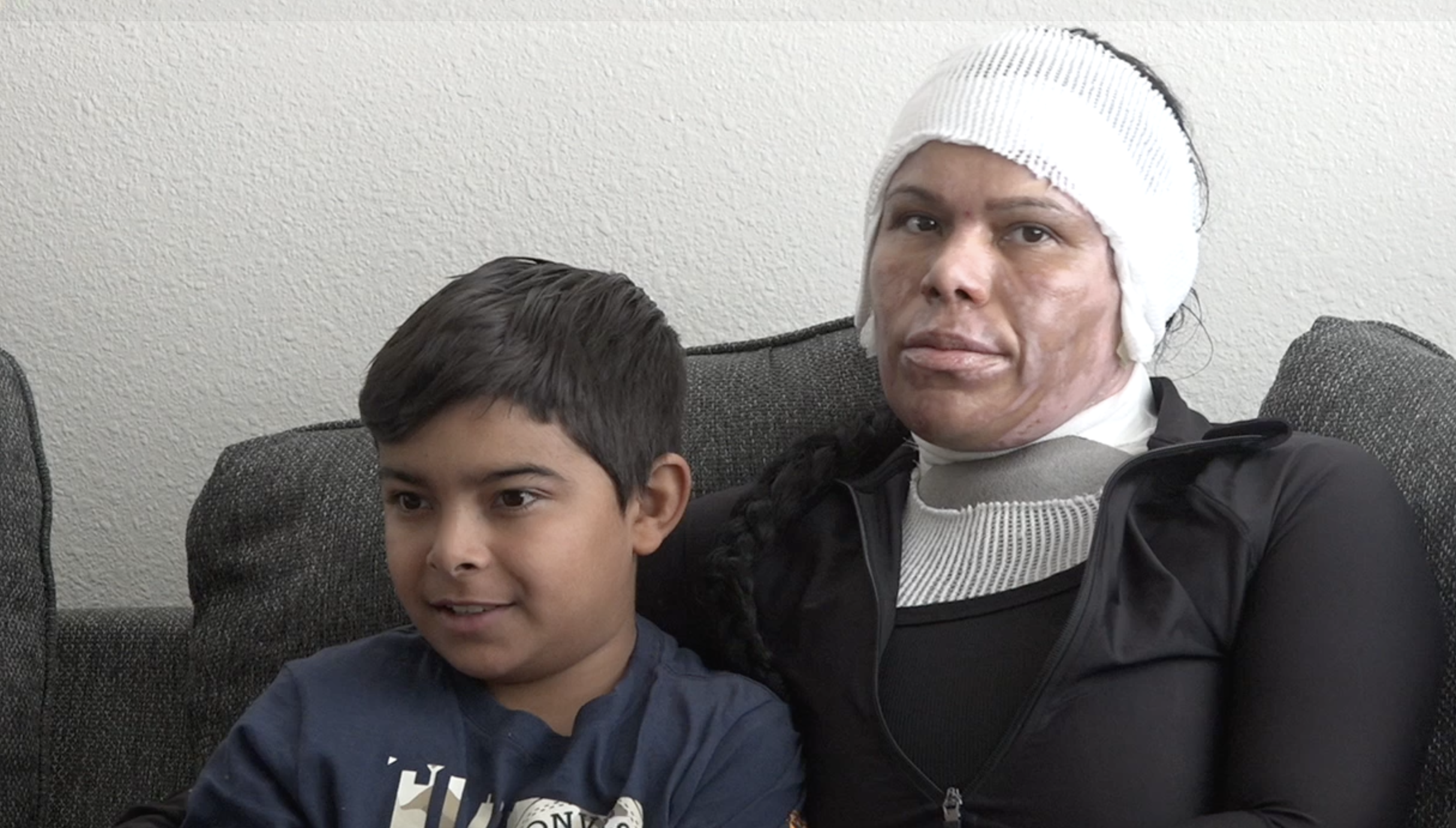 Imperial Beach burn survivor grateful for community support after kitchen explosion