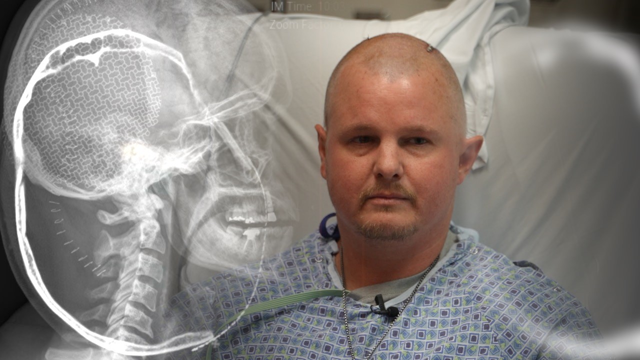 Broqsten Bunt Florida cancer patient bill reversal.jpeg