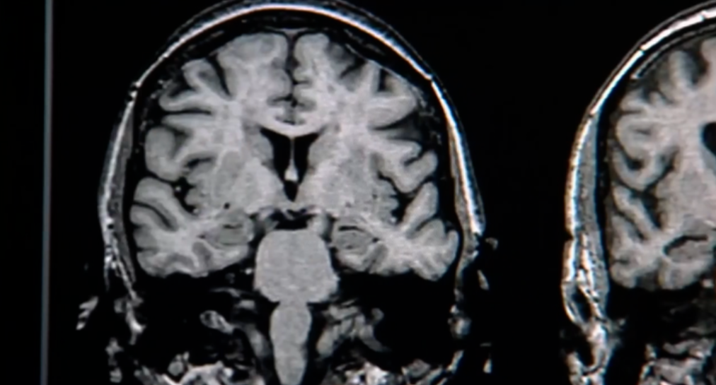 USF brainscan