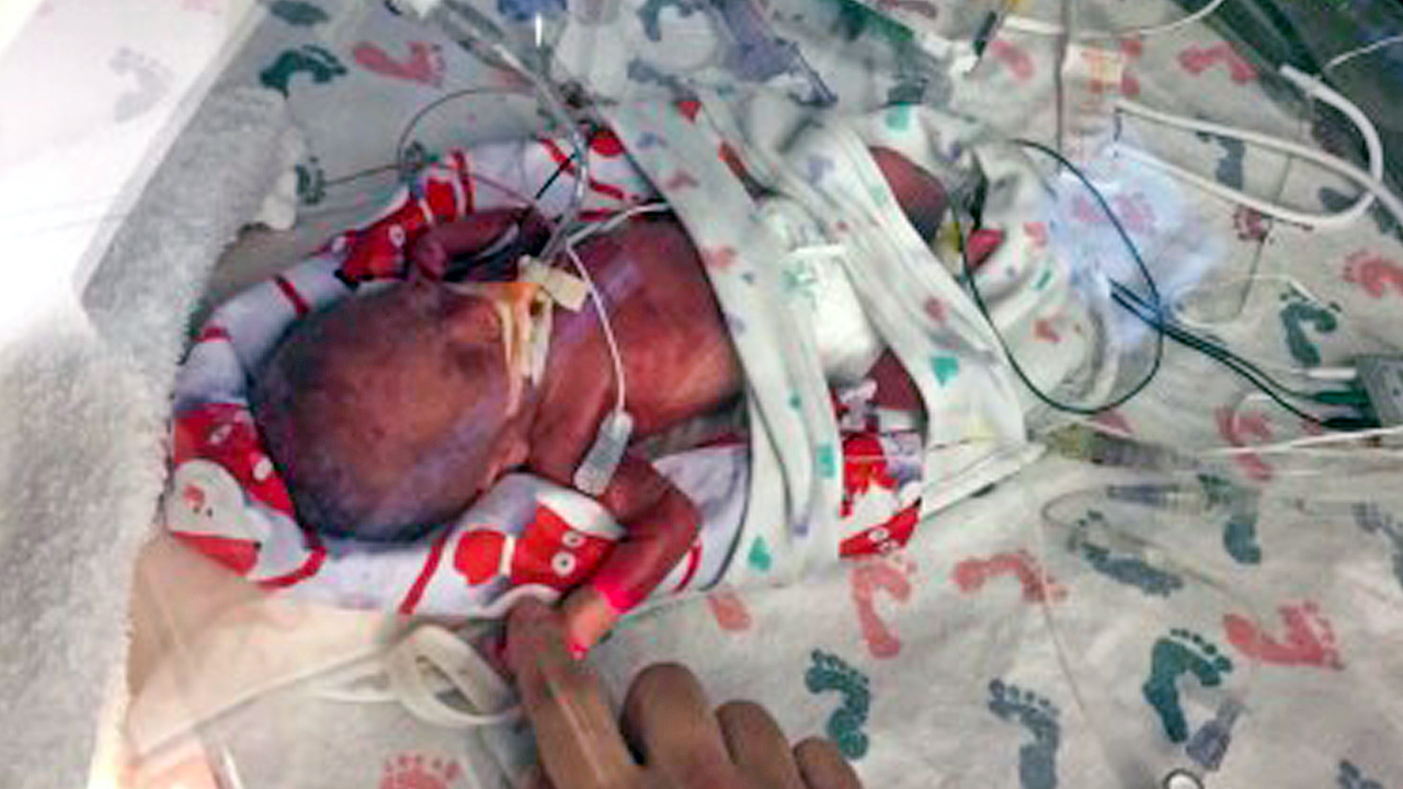 Zev micro-preemie