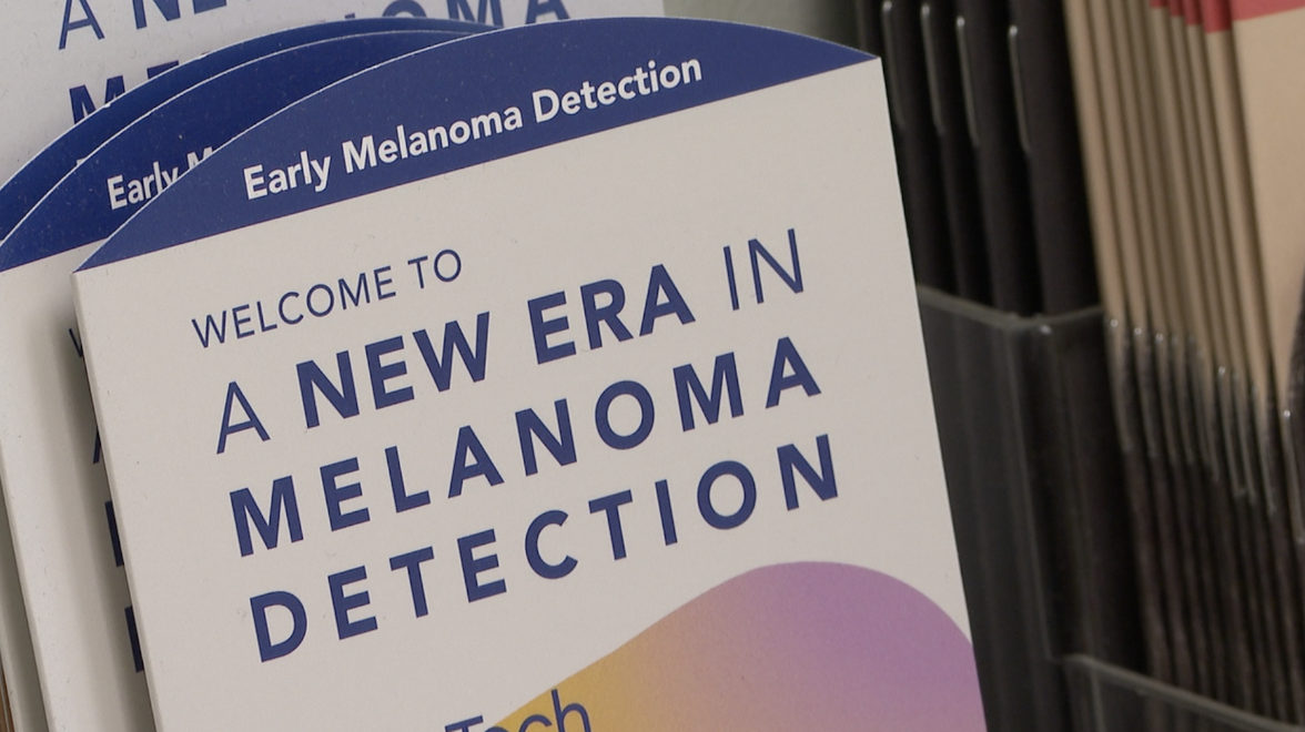 Melanoma detection sign
