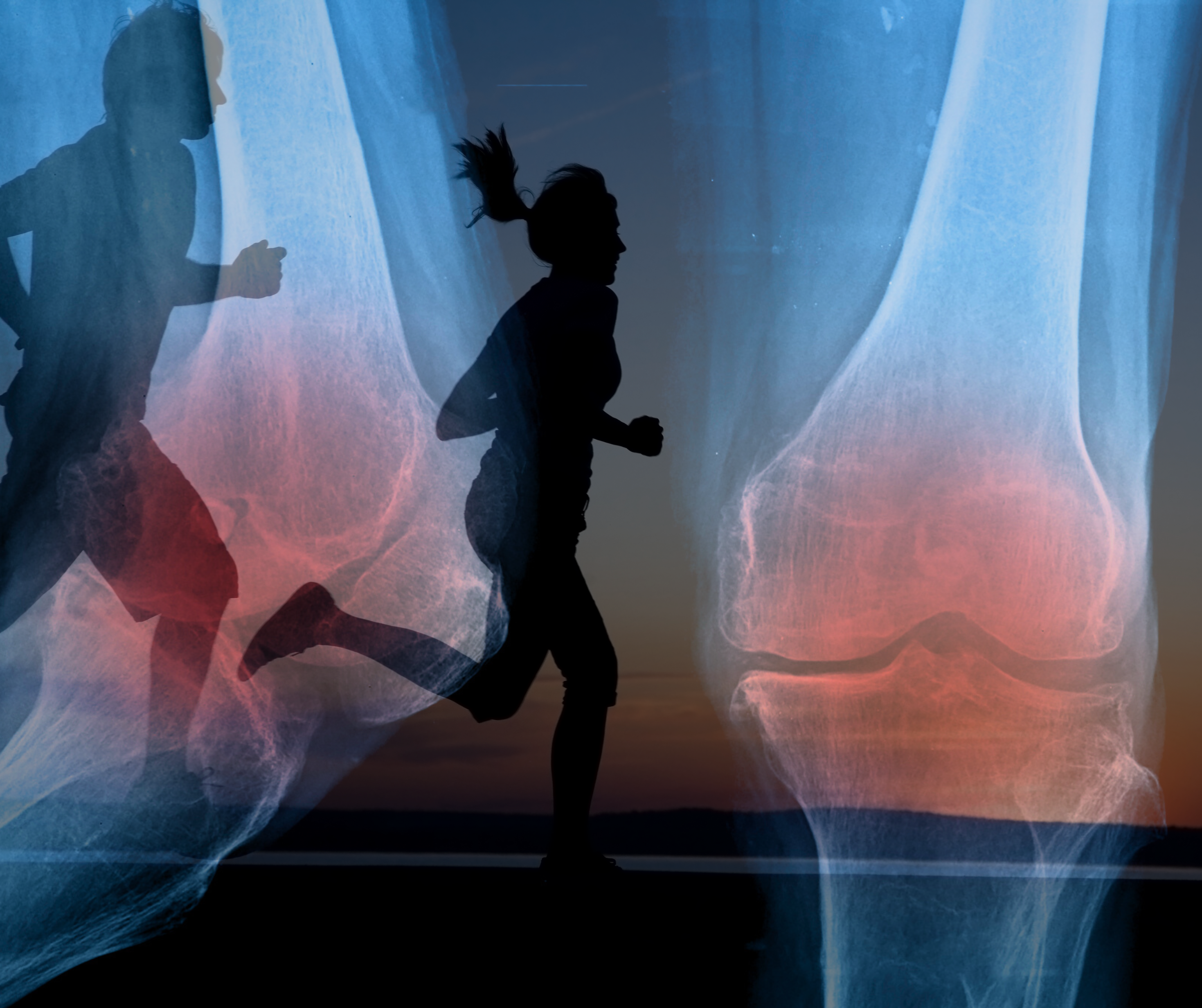 Running, exercise, arthritis