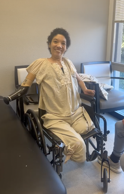 Logan Heights mother receives prosthetic arm after surviving flesh-eating disease