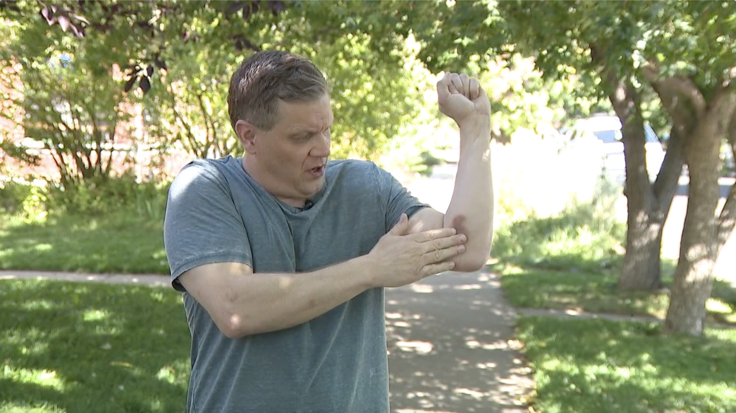 Couple says they were attacked while trying to get stolen bike back in Washington Park neighborhood