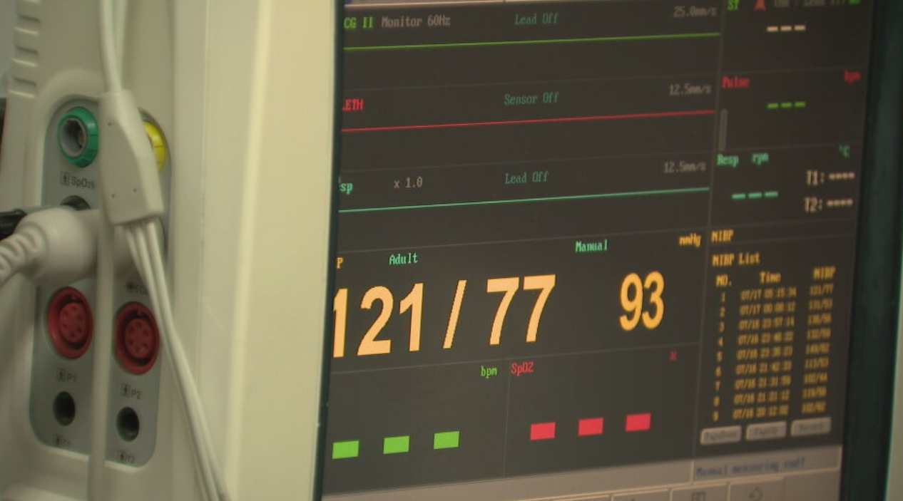 heart monitor - hospital