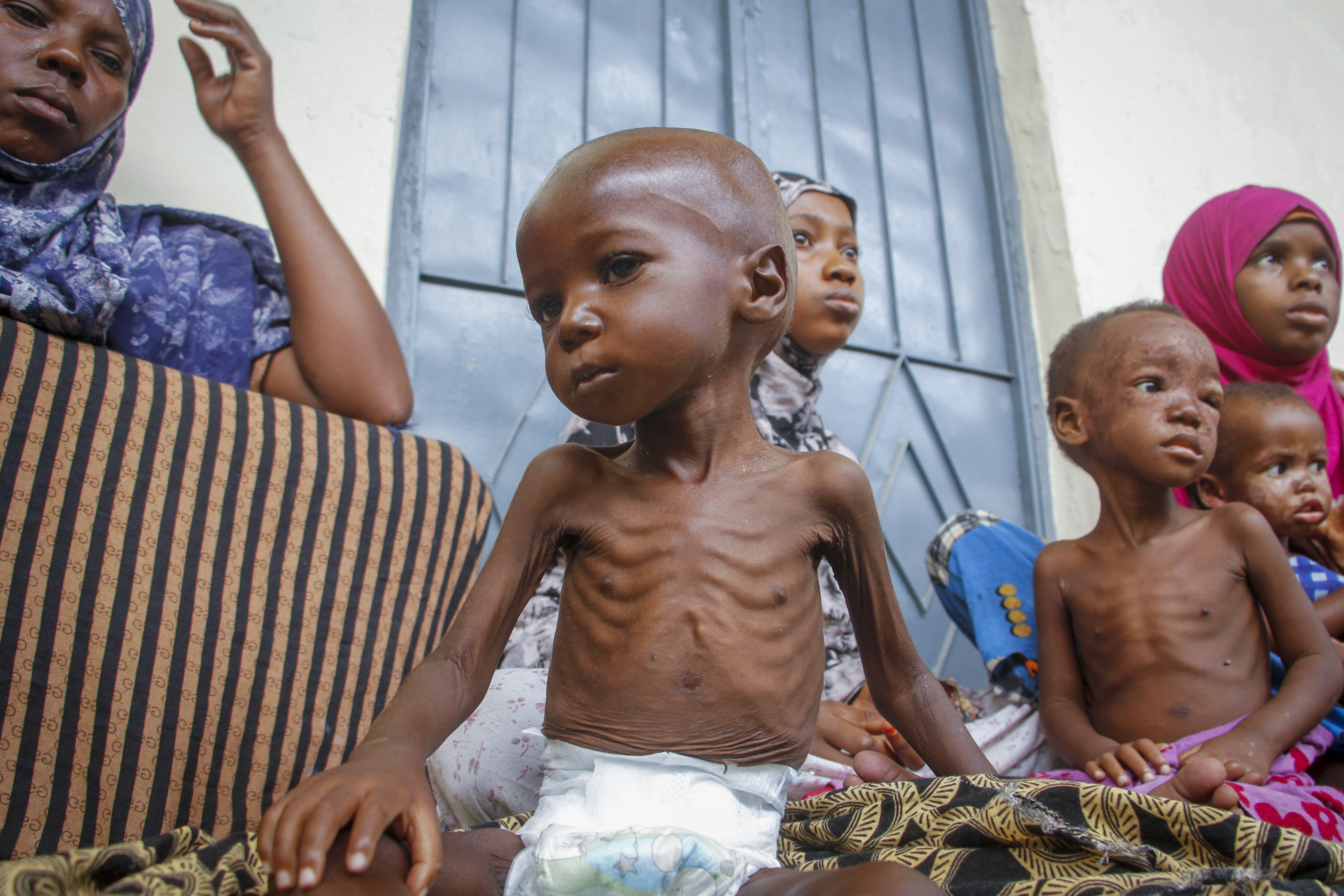 Somalia Dying in Drought