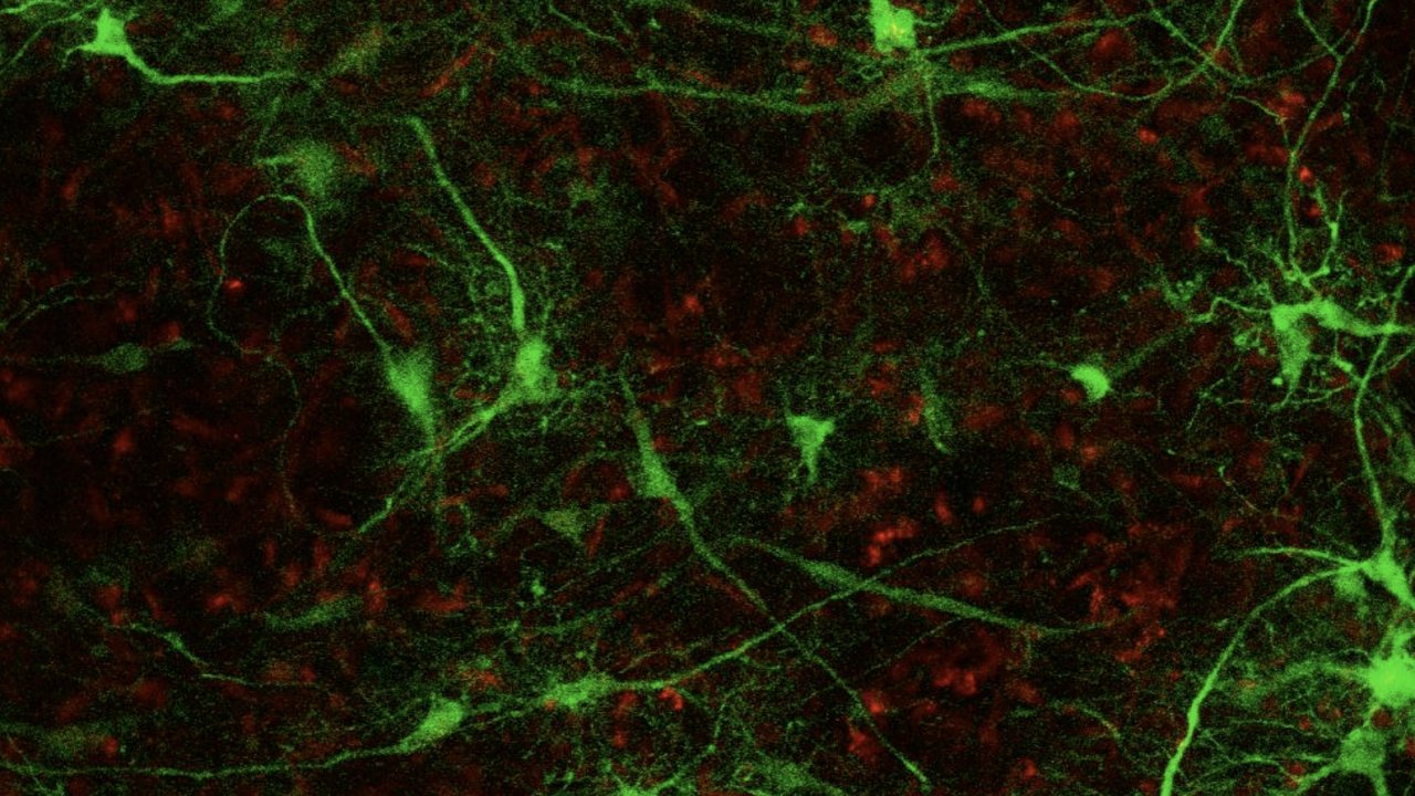 Calcium response of astrocytes within printed human brain tissue