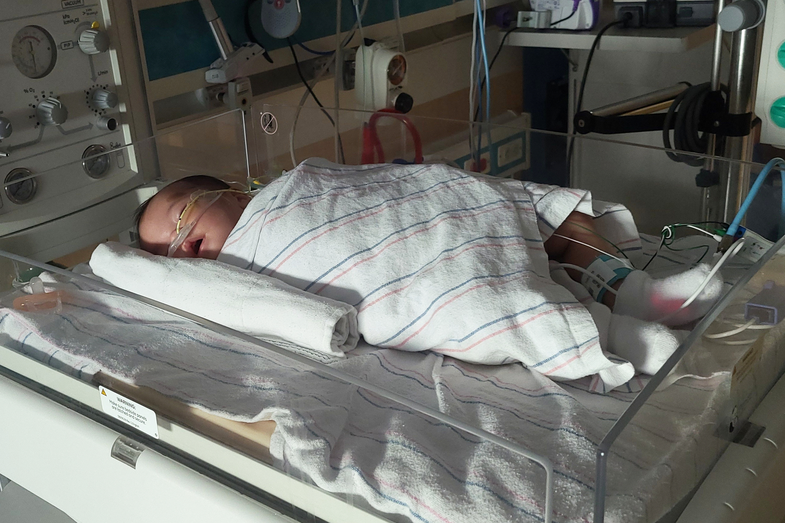 Infant Formula Botulism Recall