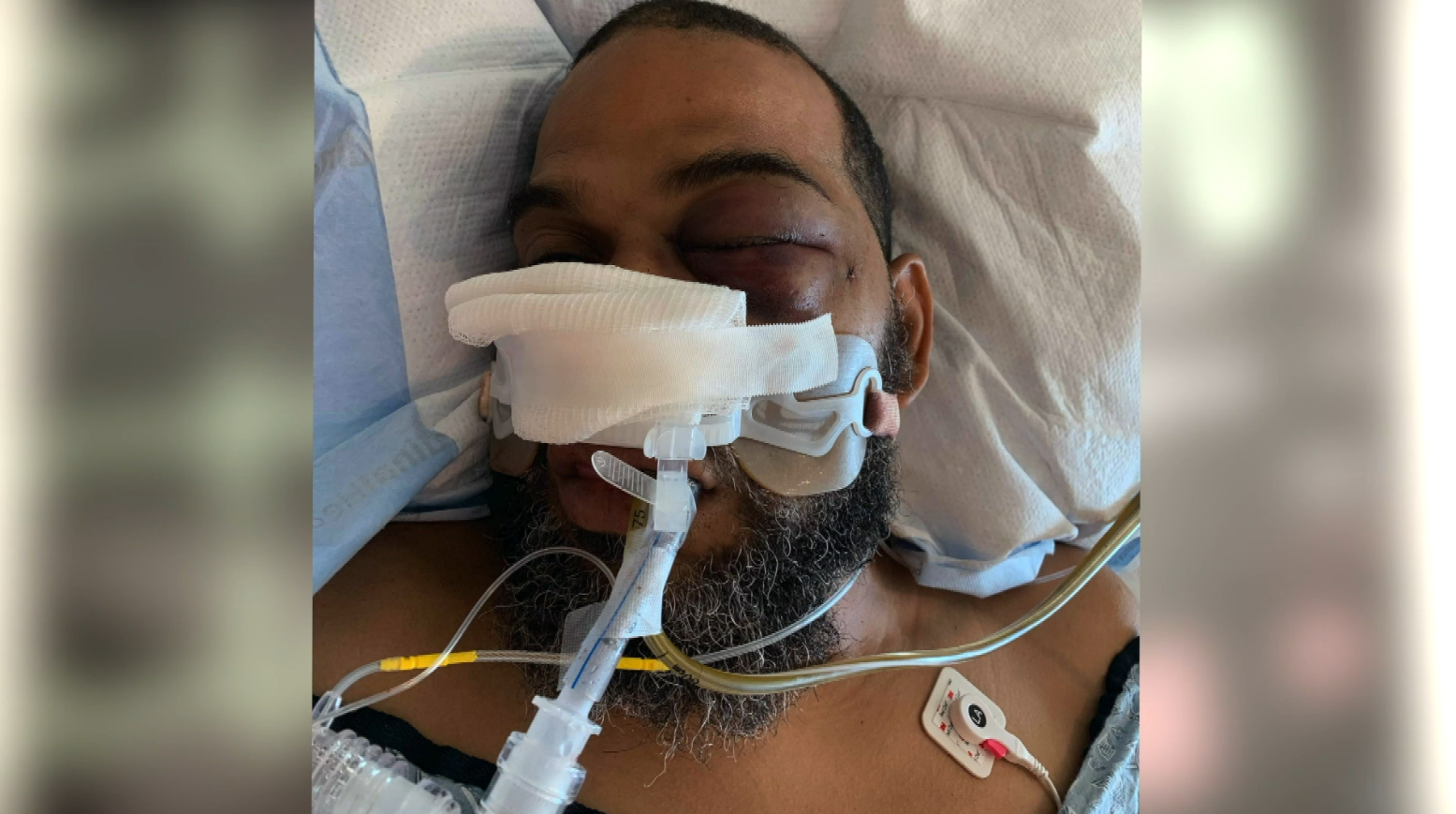 Richmond man survives gunshot to head: ‘I was a goner’