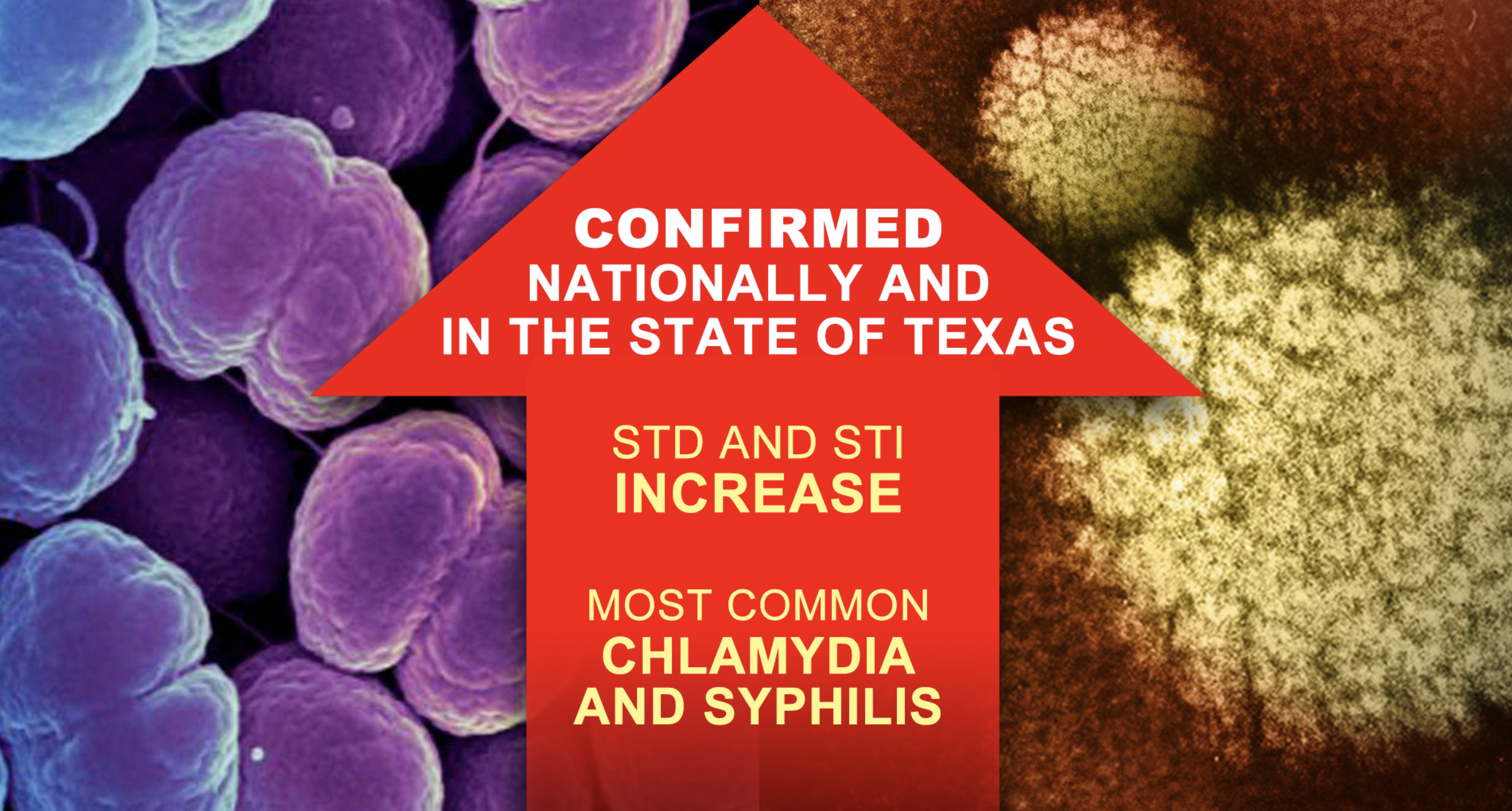 STD and STI cases on the rise in Nueces County, State of Texas - Vimarsana News