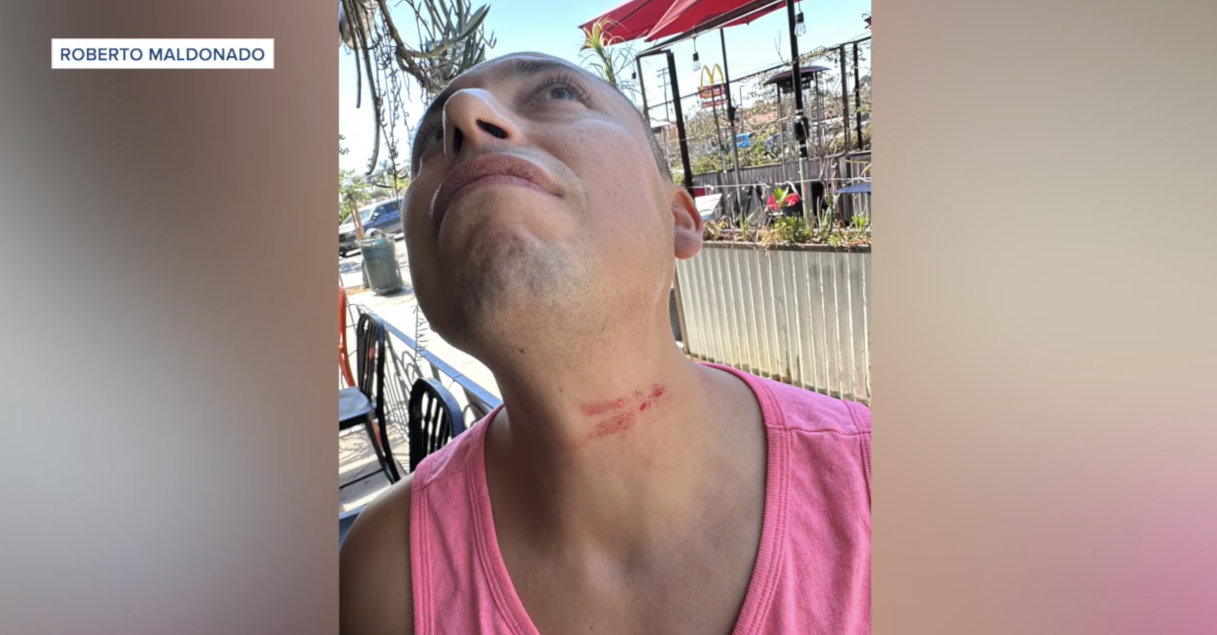 Couple describes violent encounter with transient at popular Hillcrest restaurant