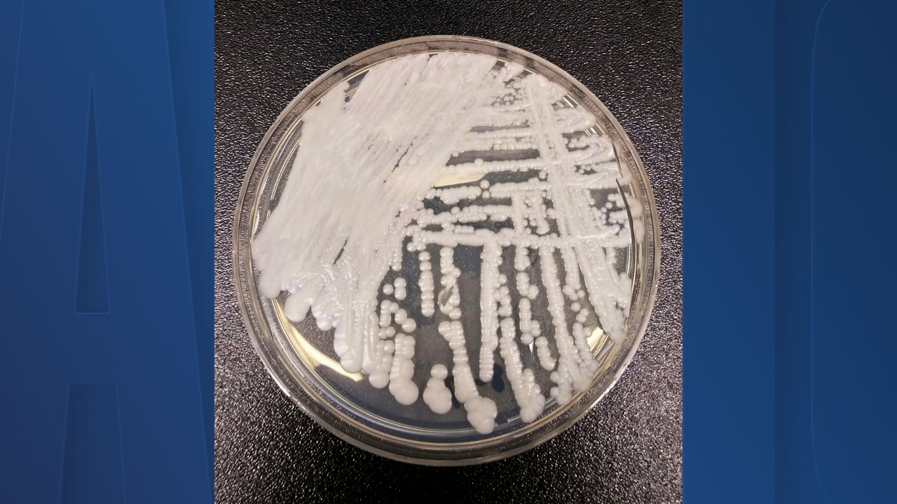 Superbug Fungus