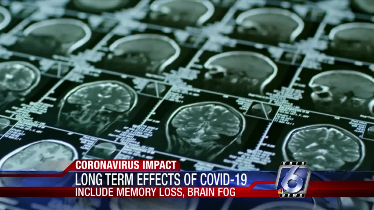 Researchers learning 'brain fog' common event after COVID-19 - Vimarsana News