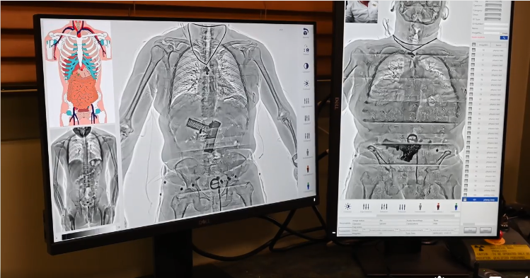 Body cavity scanning.PNG