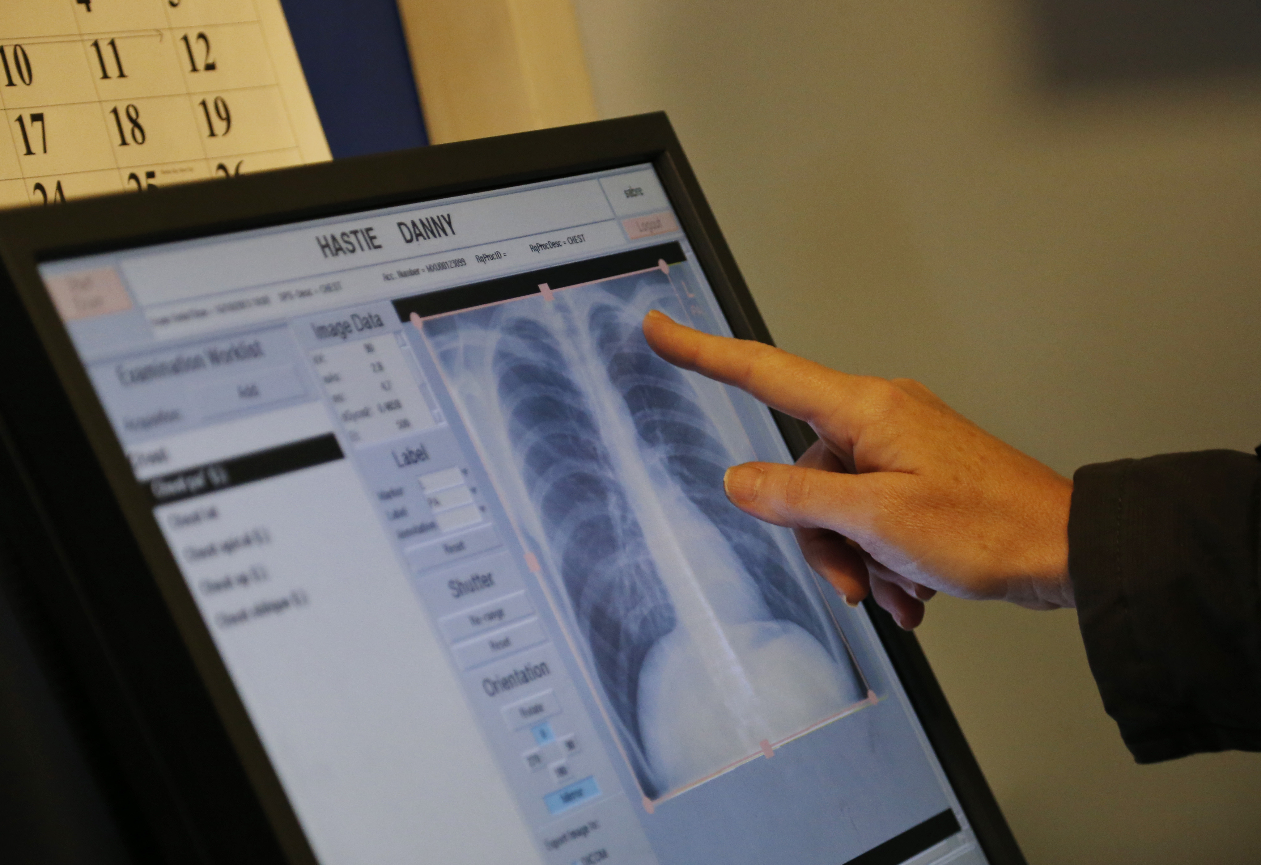 Pandemic a wake-up call for COPD patients