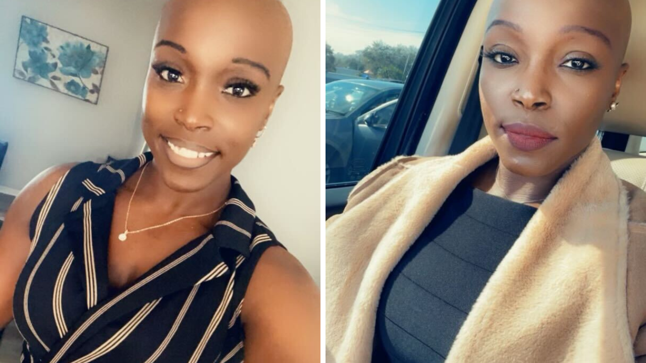 Hillsborough County mother suffers serious burns after a grilling accident