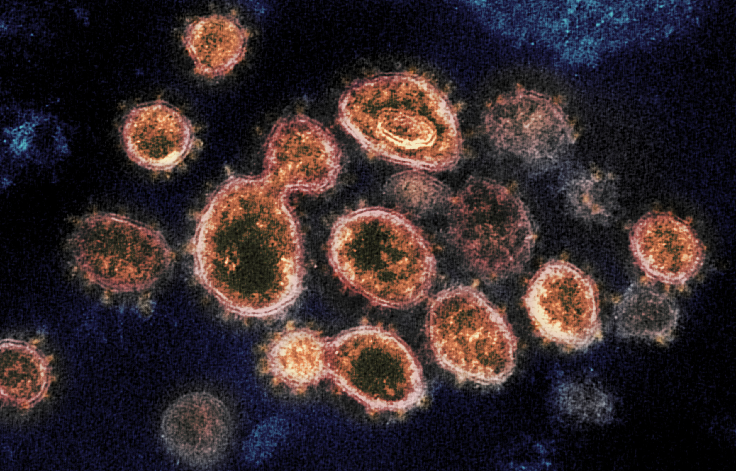 COVID-19 CELLS COVID CORONAVIRUS 