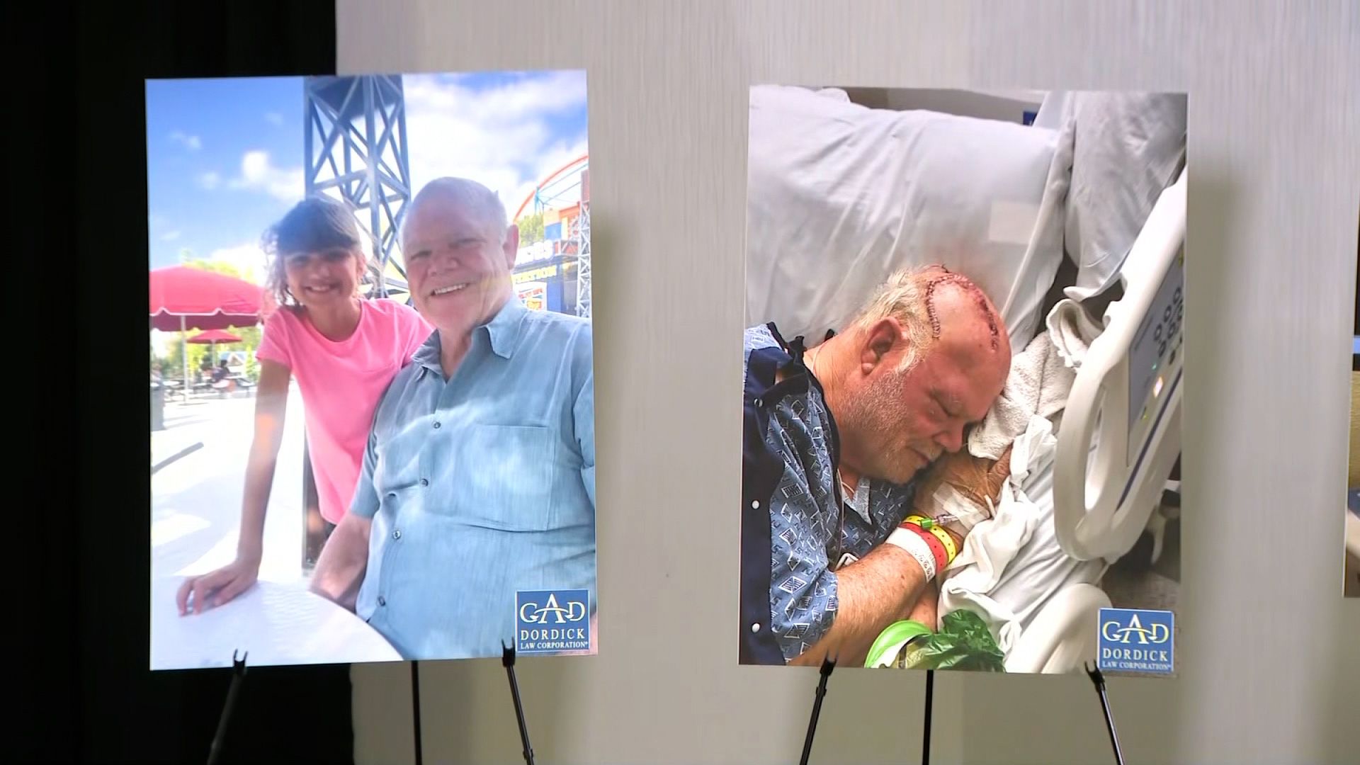 More than 100 riders allege brain injuries from Six Flags roller coaster following CNN investigation