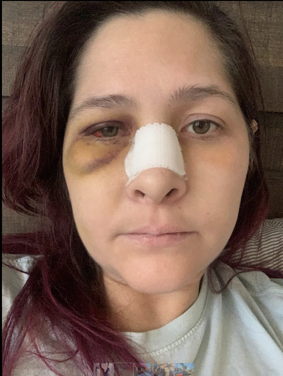 Woman brutally attacked outside Encinitas bar