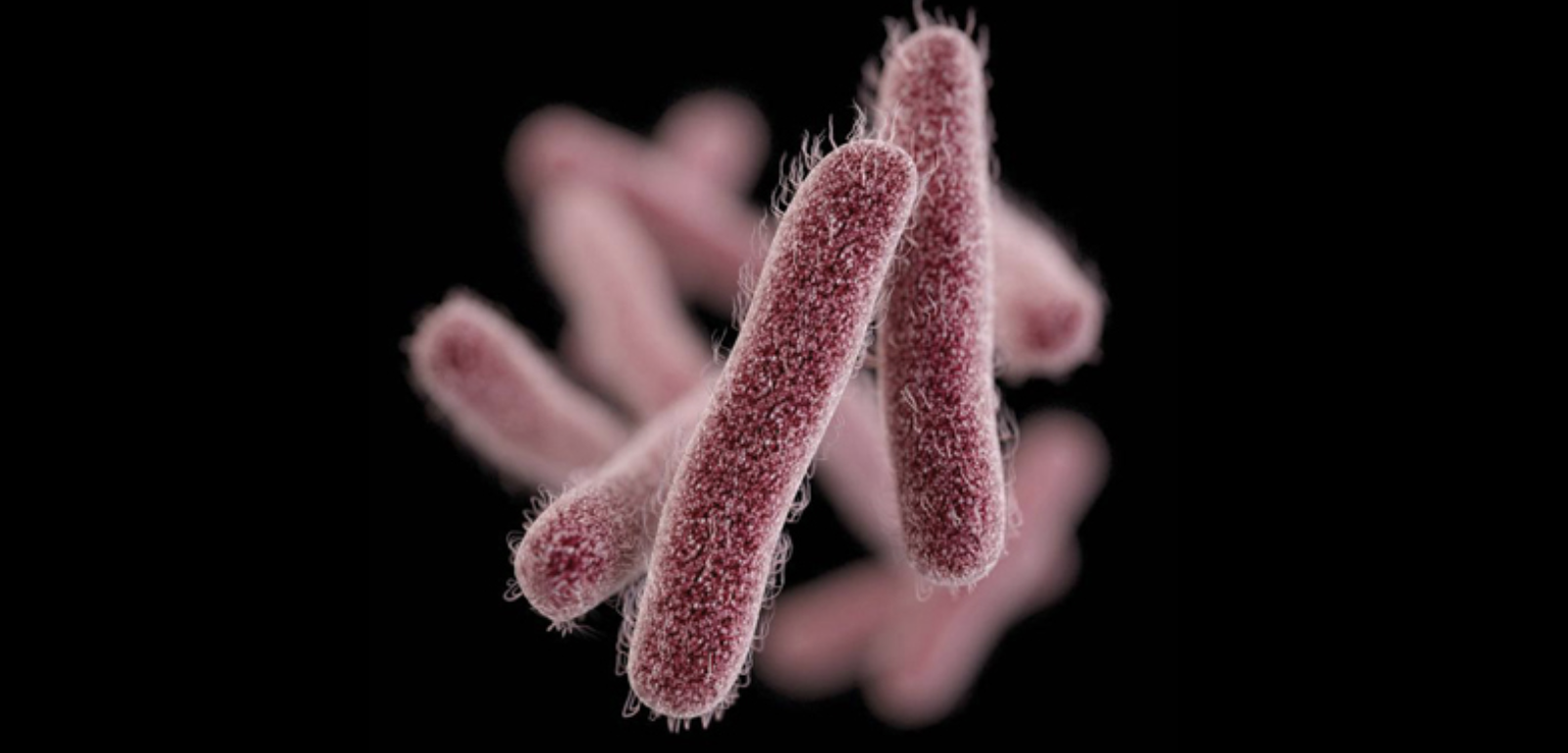 Shigellosis