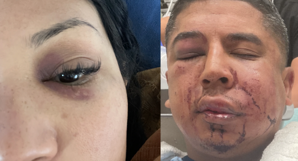 Couple beaten, mugged outside food truck in Chula Vista