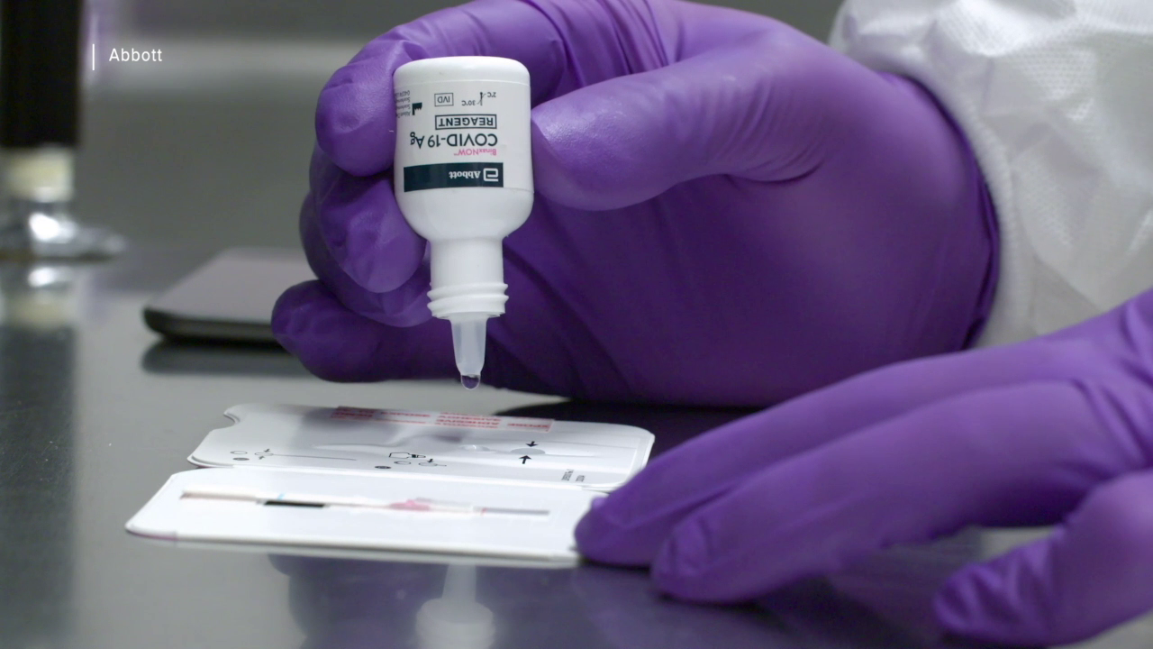 COVID-19 antigen test promises results in minutes and no lab is needed