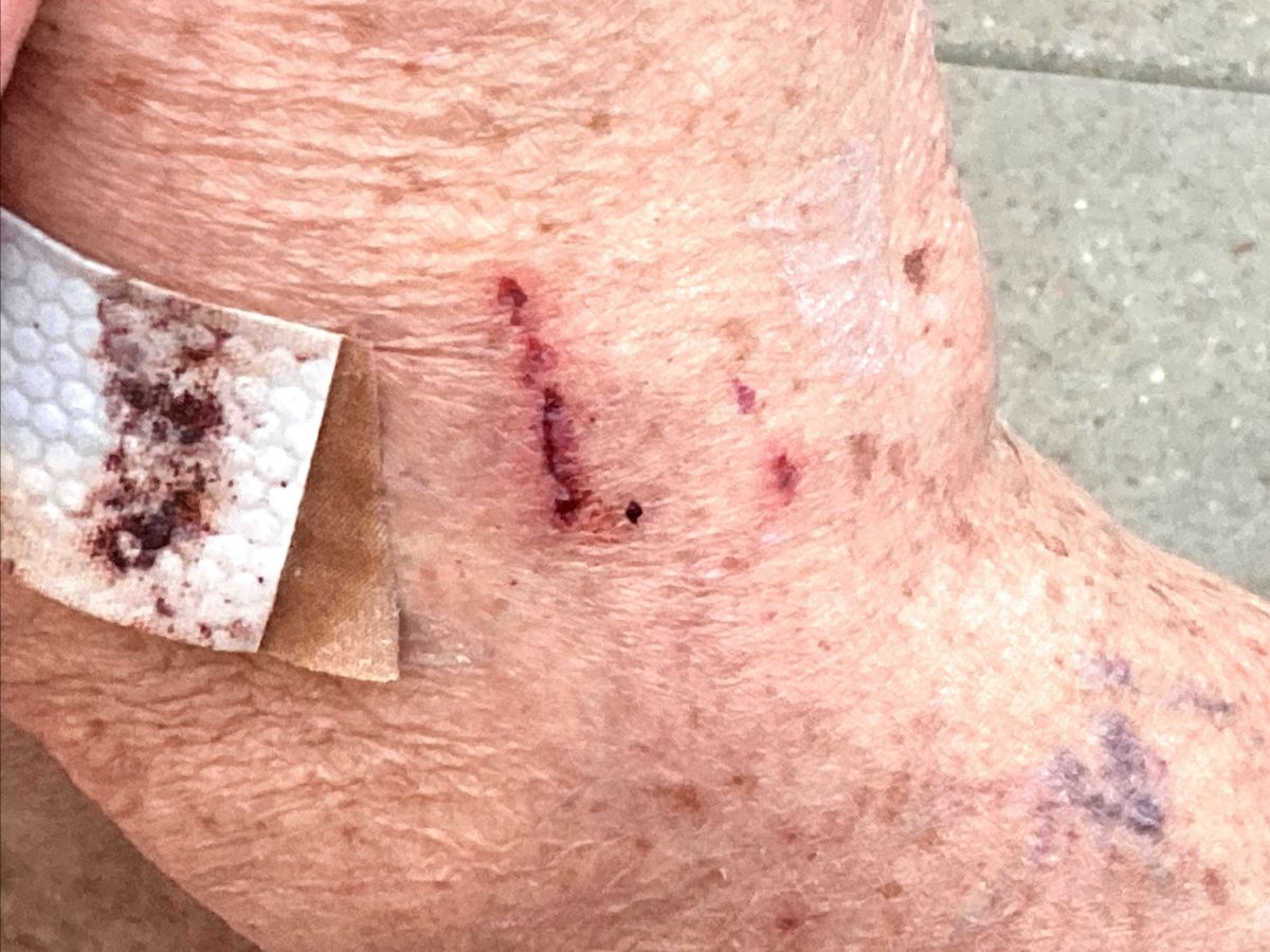 Woman Scratched 