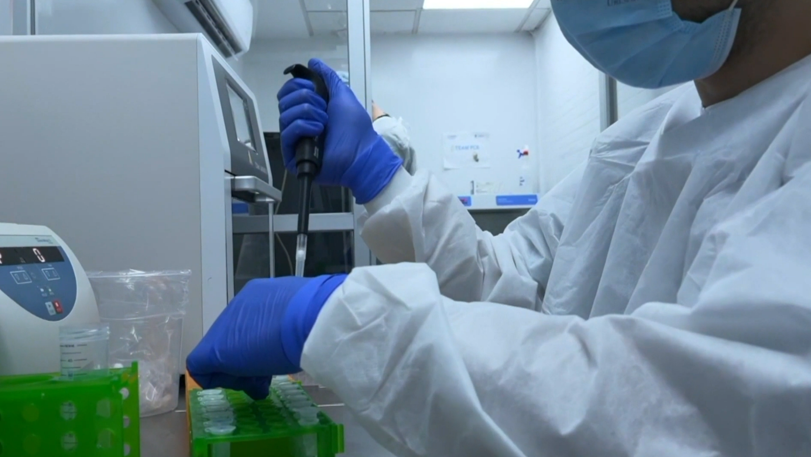 After monkeypox diagnosis in Central Virginia, doctor urges people to know signs, symptoms