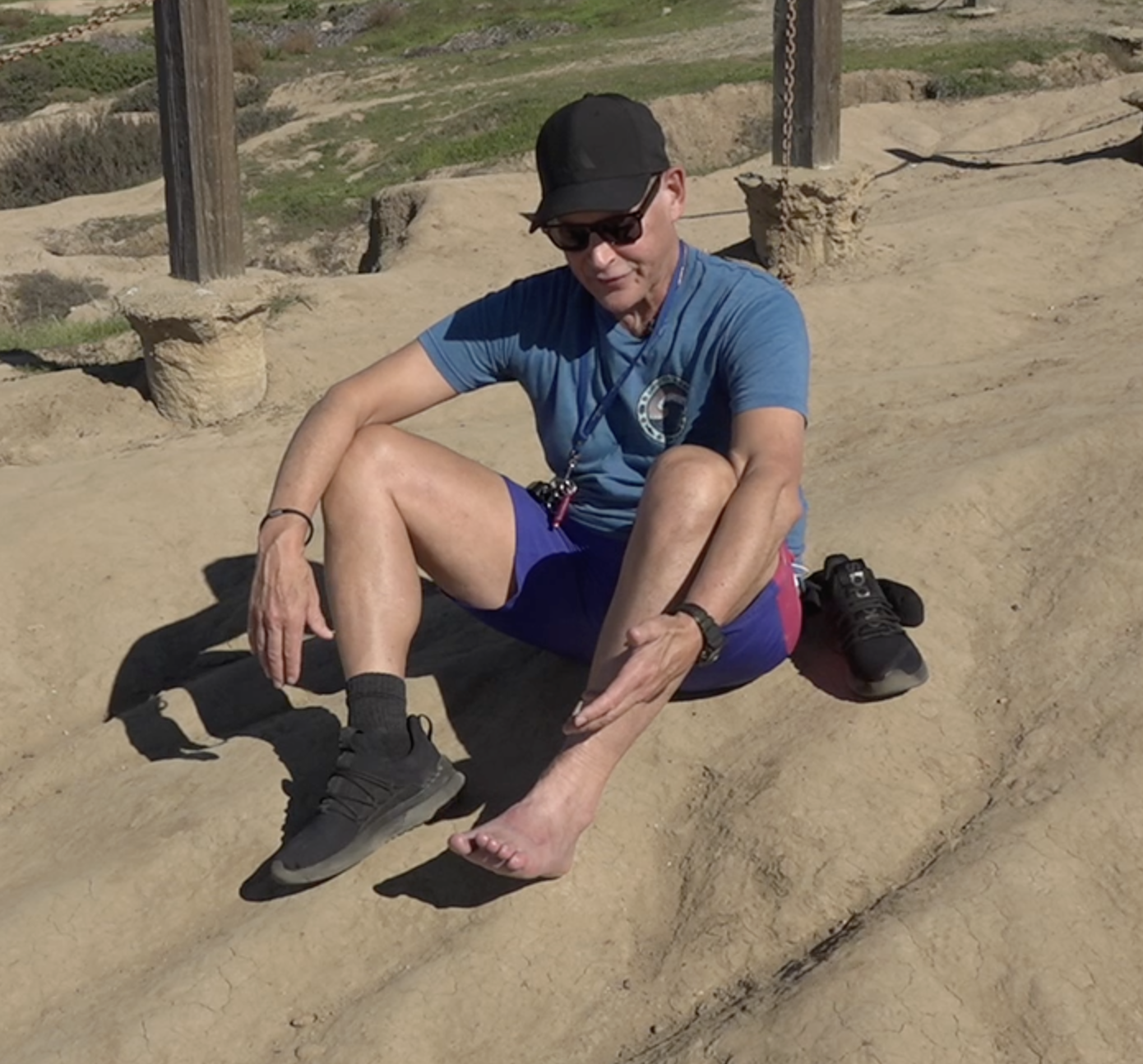 Former San Diego man recovers from flesh-eating disease caused by stingray sting at Black's Beach