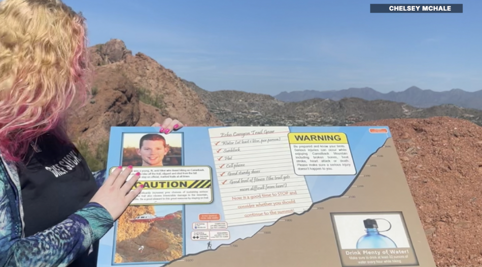 Camelback sign