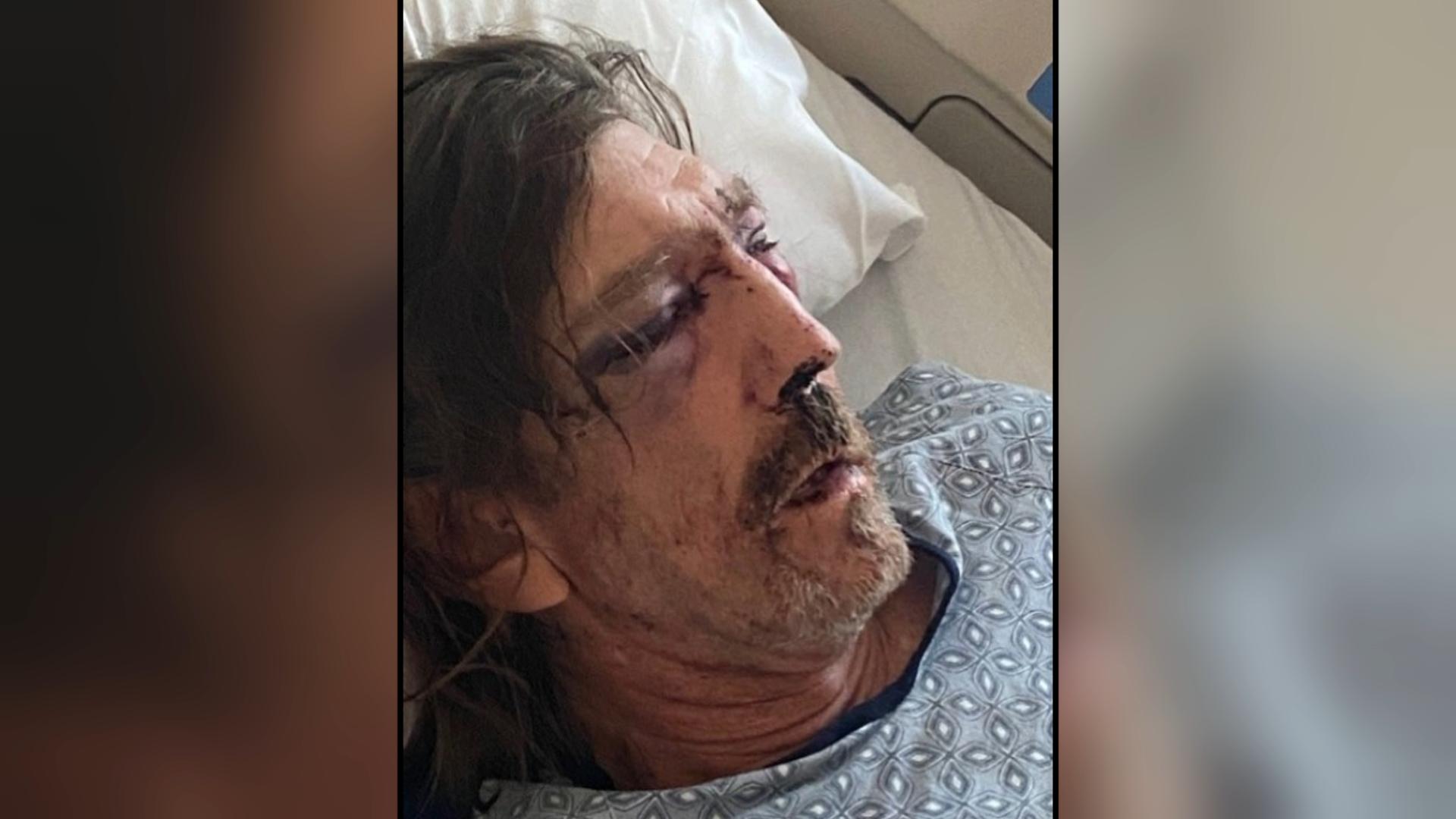 Jones in Hosp.jpg