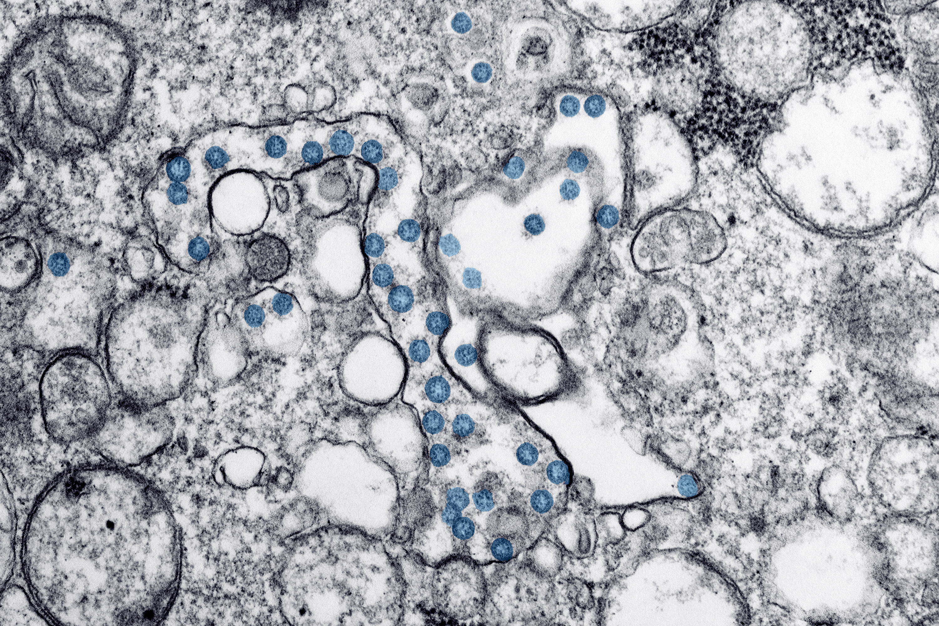 BBB warns of scammers selling phony COVID-19 antibody tests