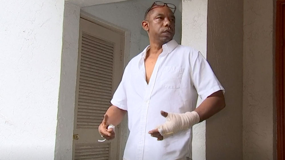 wptv-man-attacked-by-raccoon-.jpg