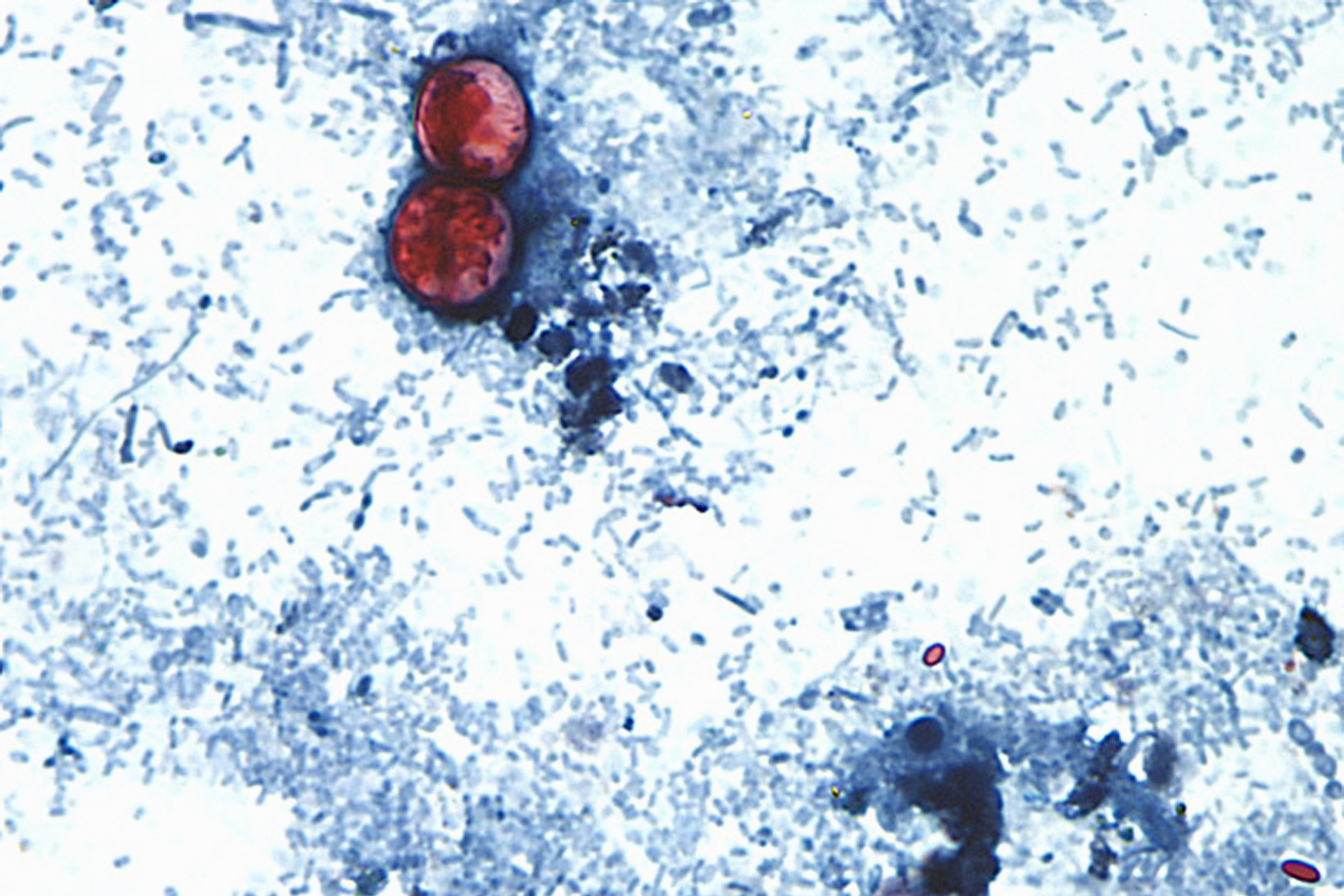 Cyclospora Outbreak History