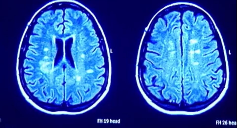 Brain XRay MRI Generic.jpg