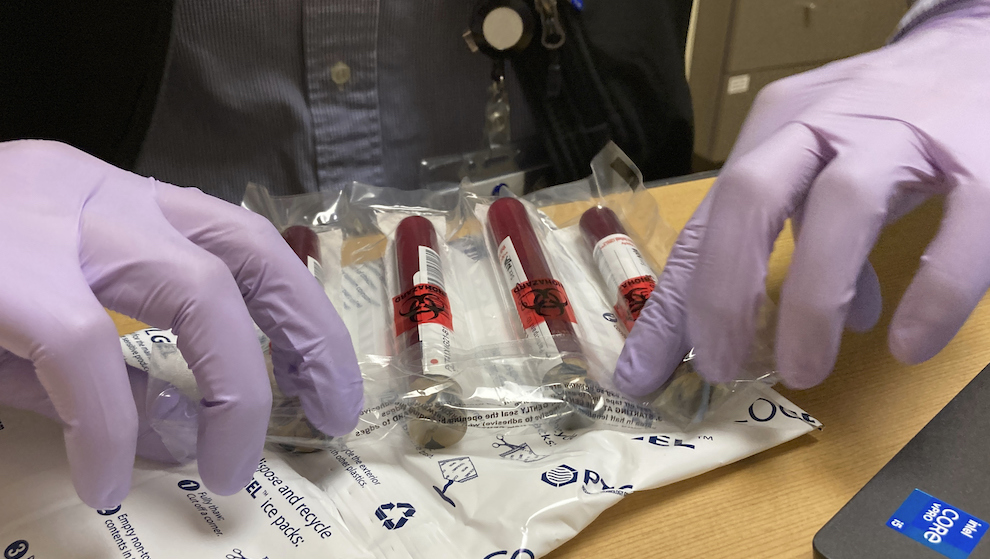 Cancer Blood Test