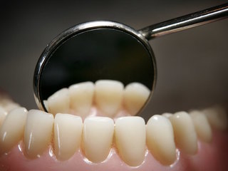 Dentists Offering NHS Treatment Continue To Dwindle