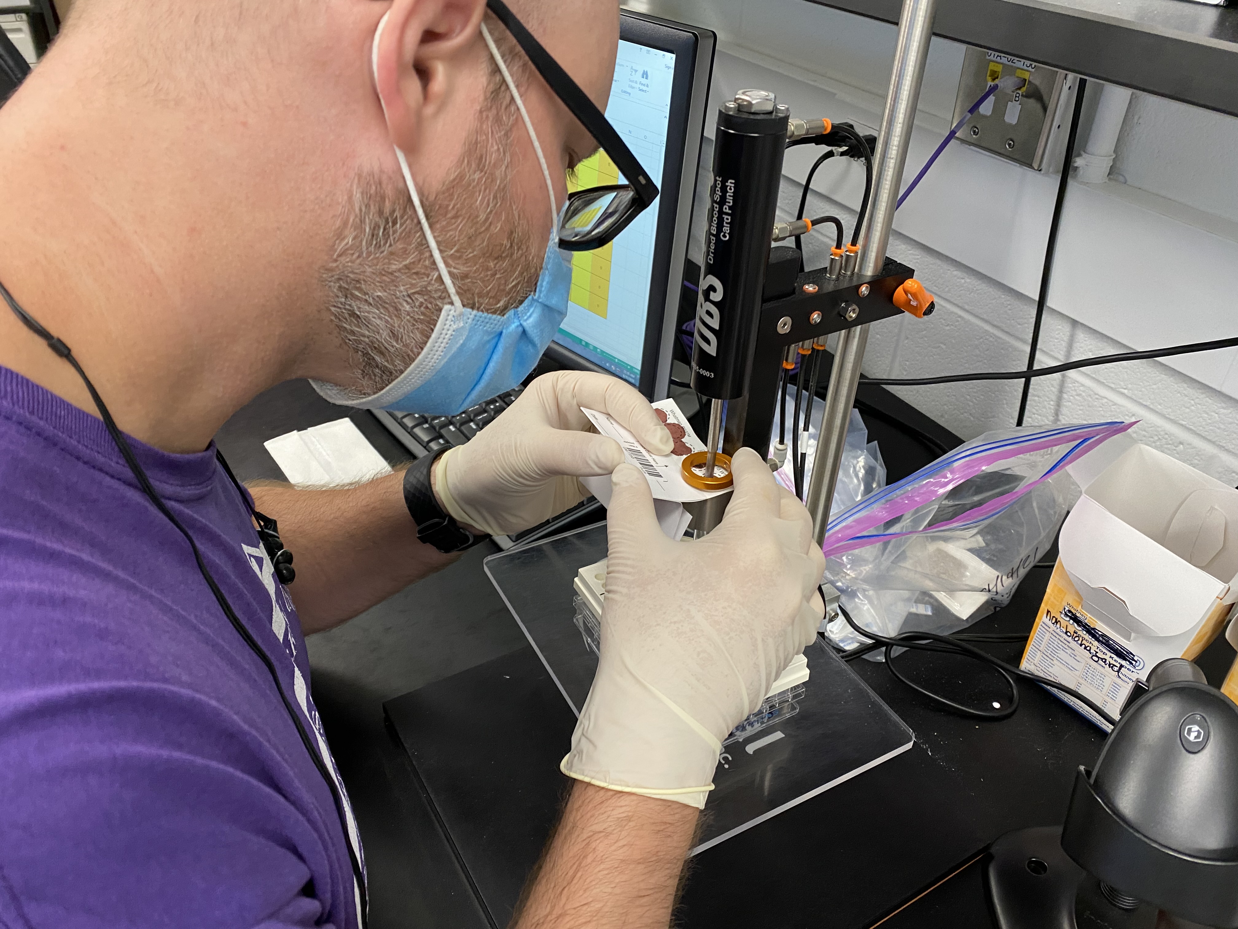 antibody test study