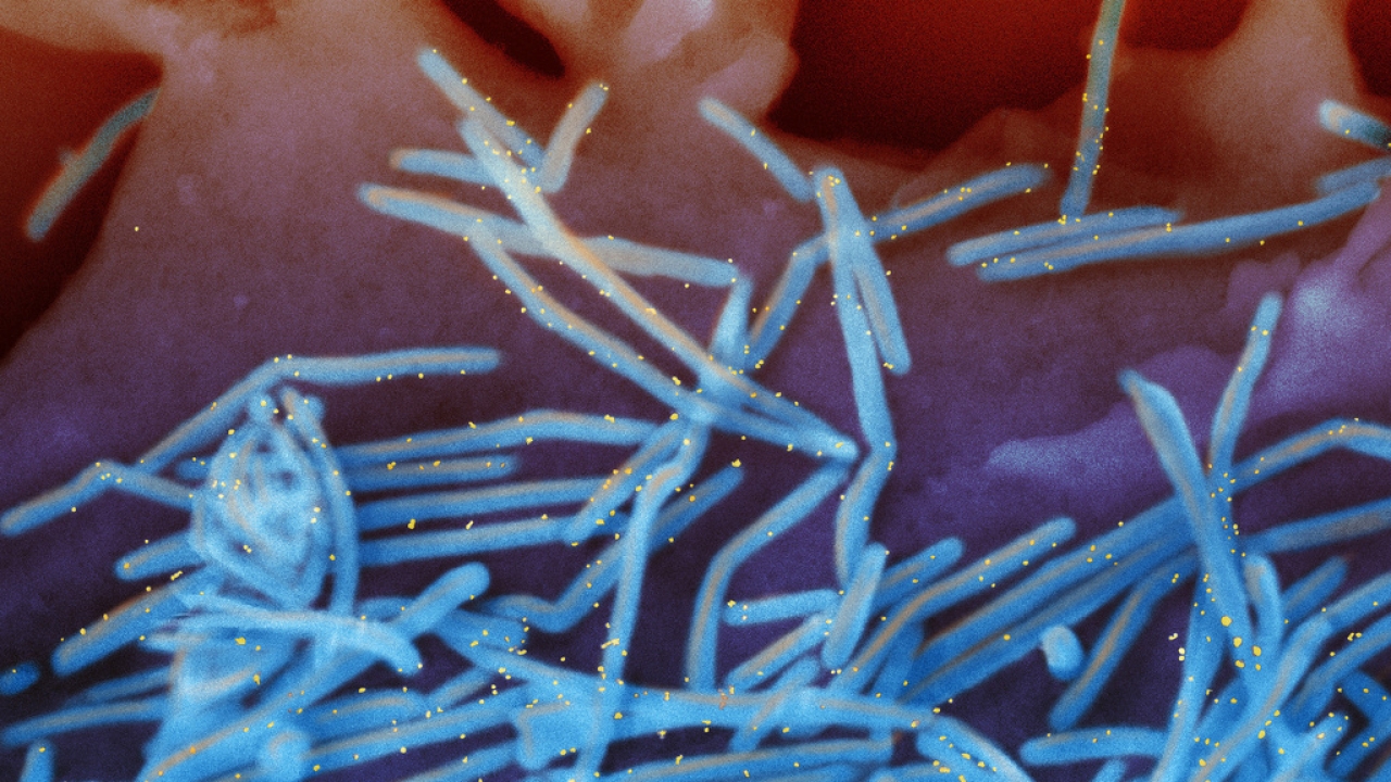 This electron microscope image provided by the National Institutes of Health shows human RSV.