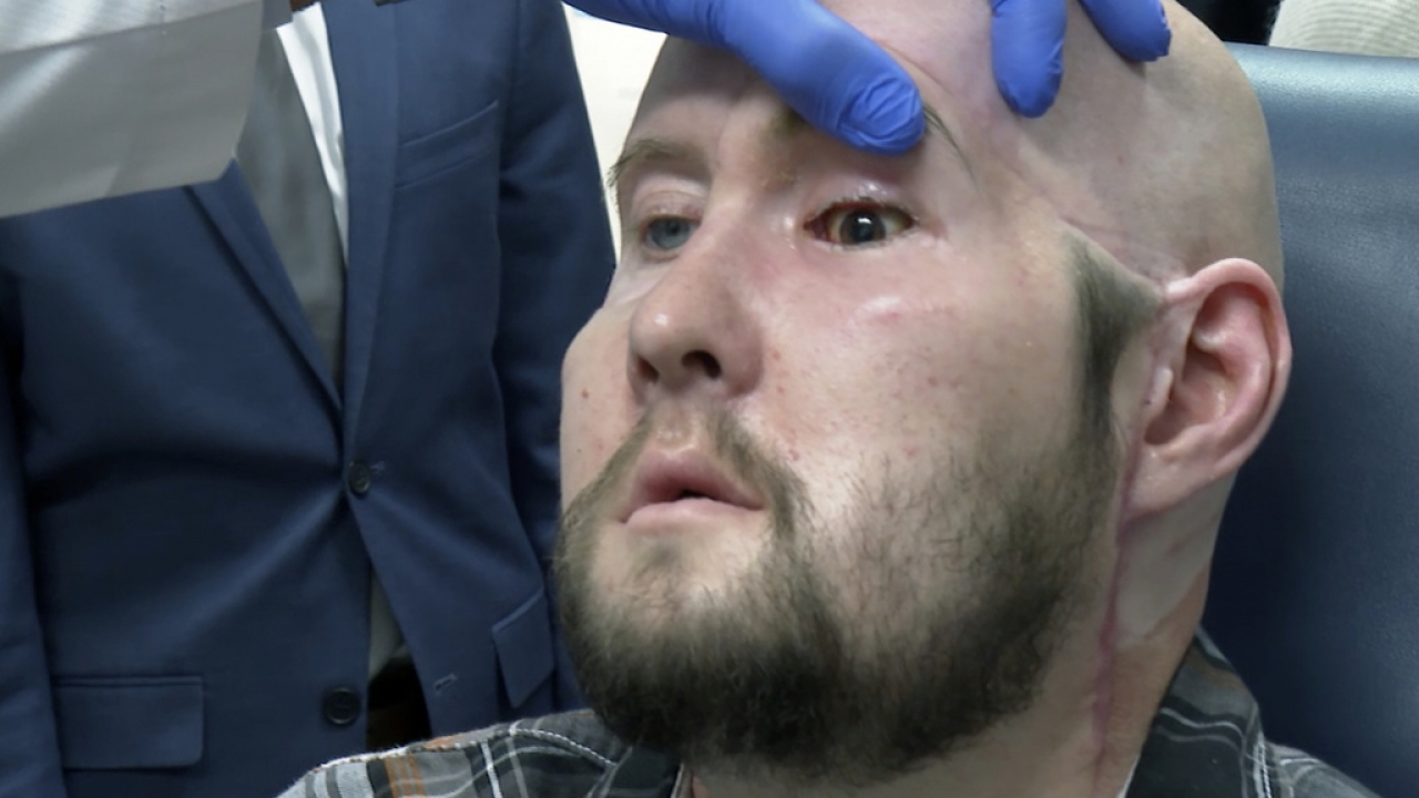 Dr. Eduardo Rodriguez examines Aaron James.